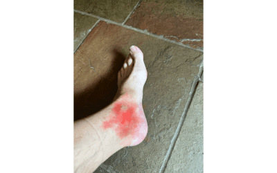Book 5 Outline and Gout